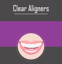 Clear Aligners - Almost Invisible Braces Mason, OH