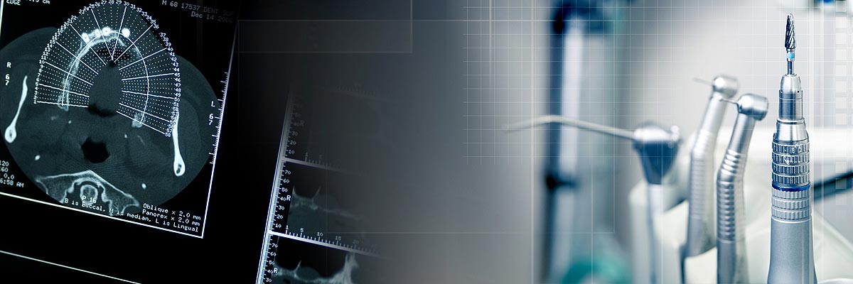 Mason Will I Need a Bone Graft for Dental Implants?