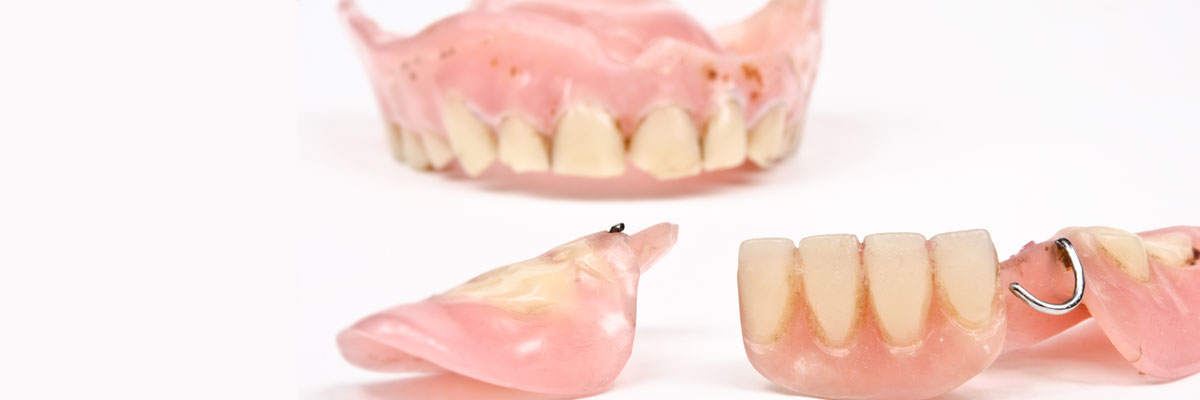 Mason What Do I Do If I Damage My Dentures?