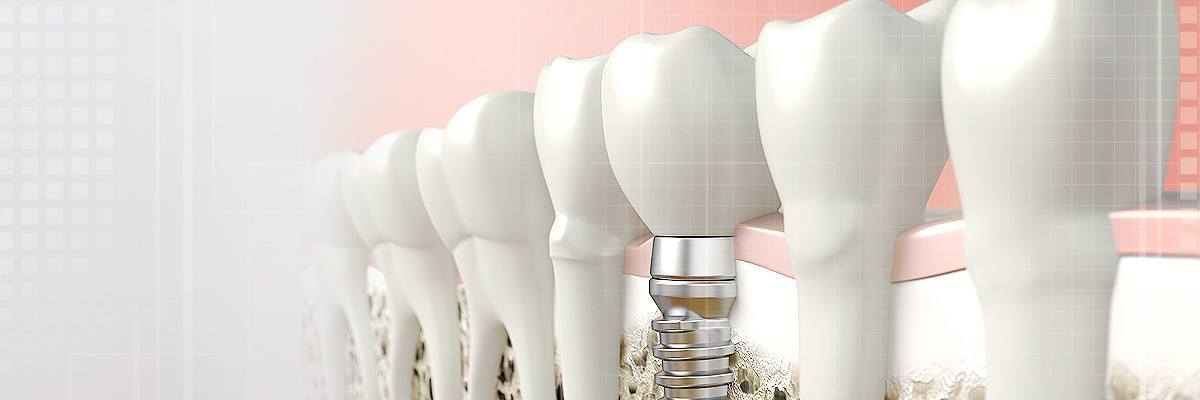 Mason Dental Prosthetics