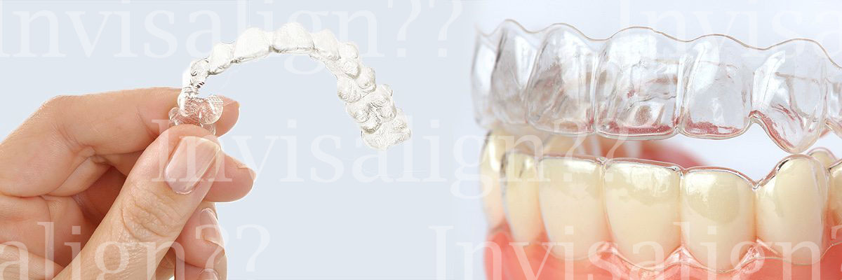 Mason Does Invisalign® Really Work?