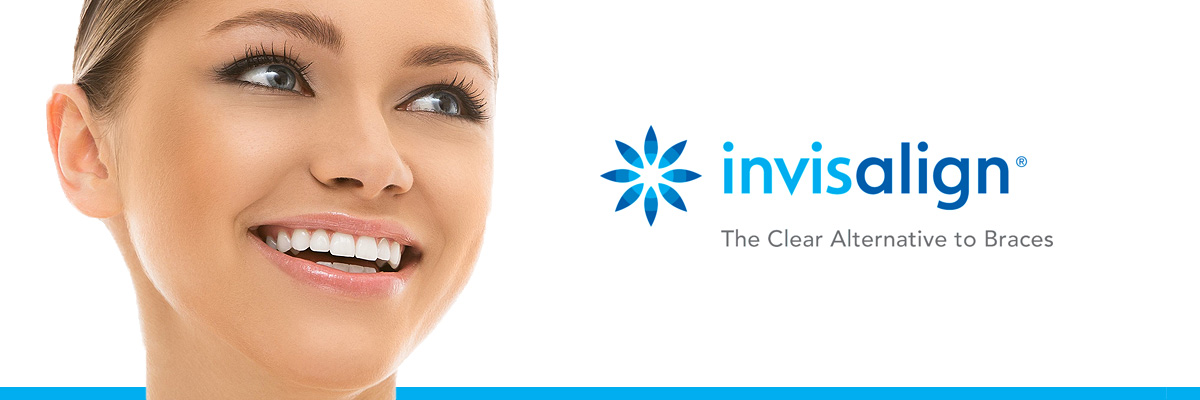 Mason Invisalign for Teens