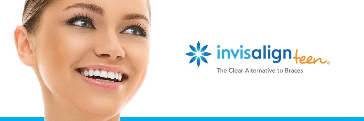 Mason Invisalign vs Traditional Braces