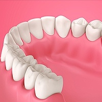 Periodontics Mason, OH