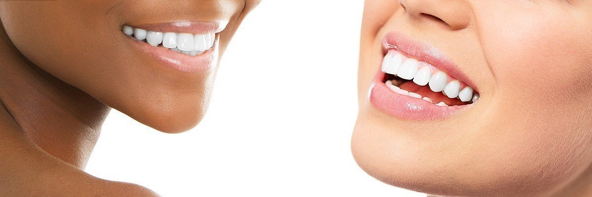 Mason Dental Restoration