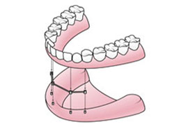 TeethXpress