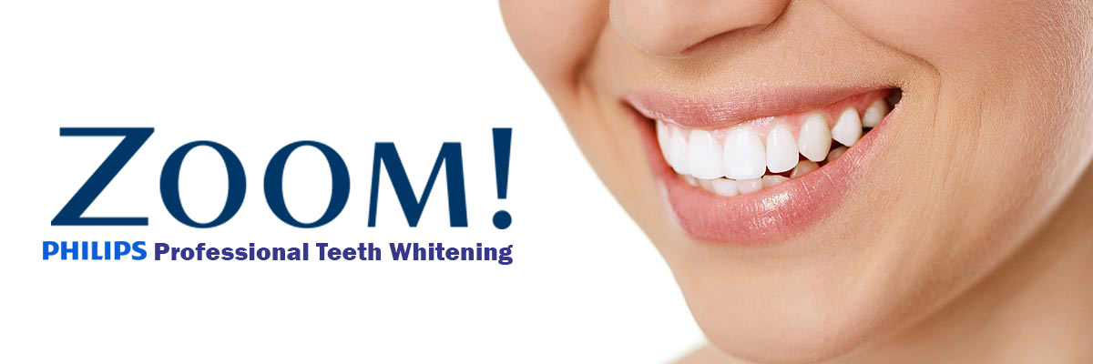 Mason Zoom Teeth Whitening